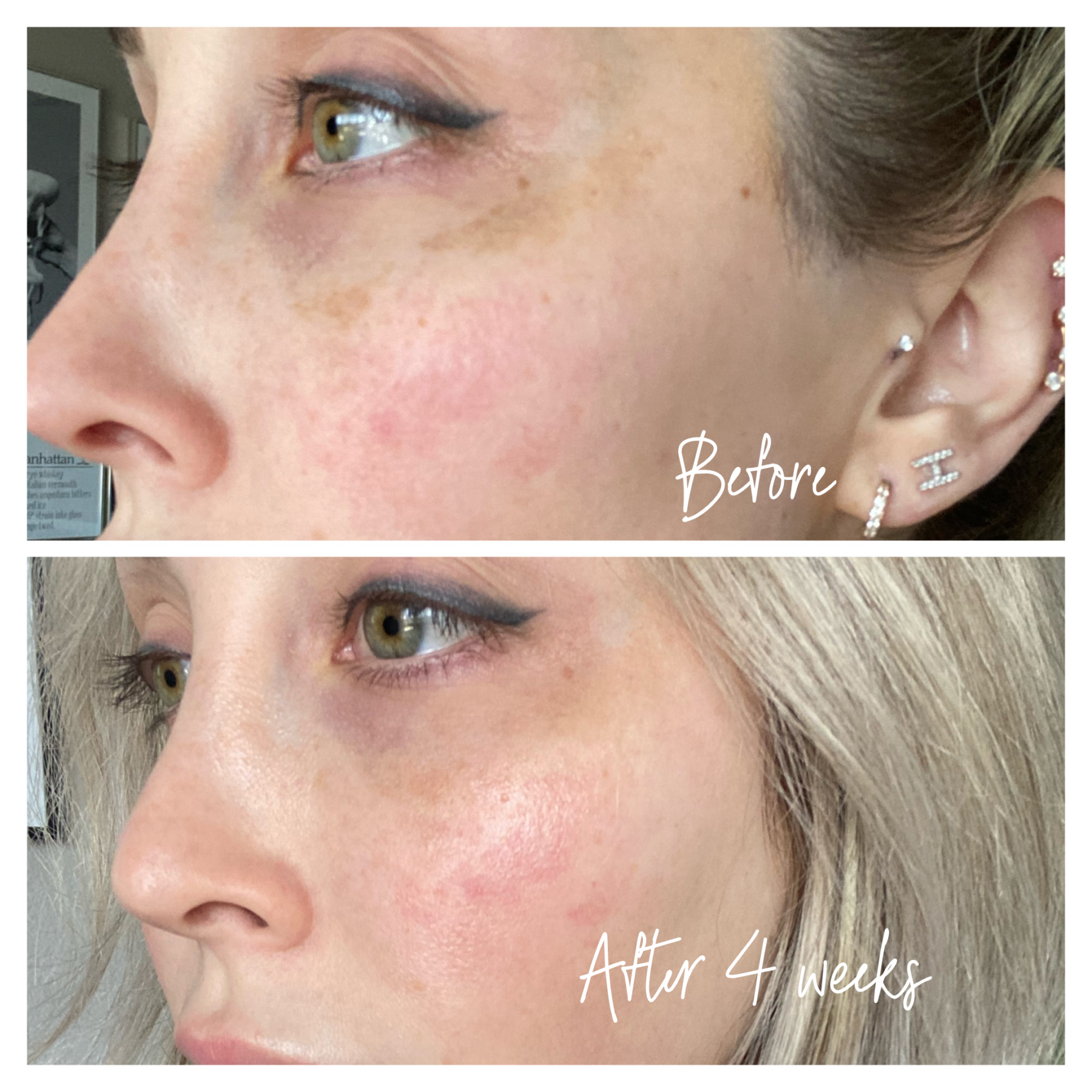 Musely Dark Spot Remover | Skincare | Sun Spots | Blondie in the City by Hayley Larue