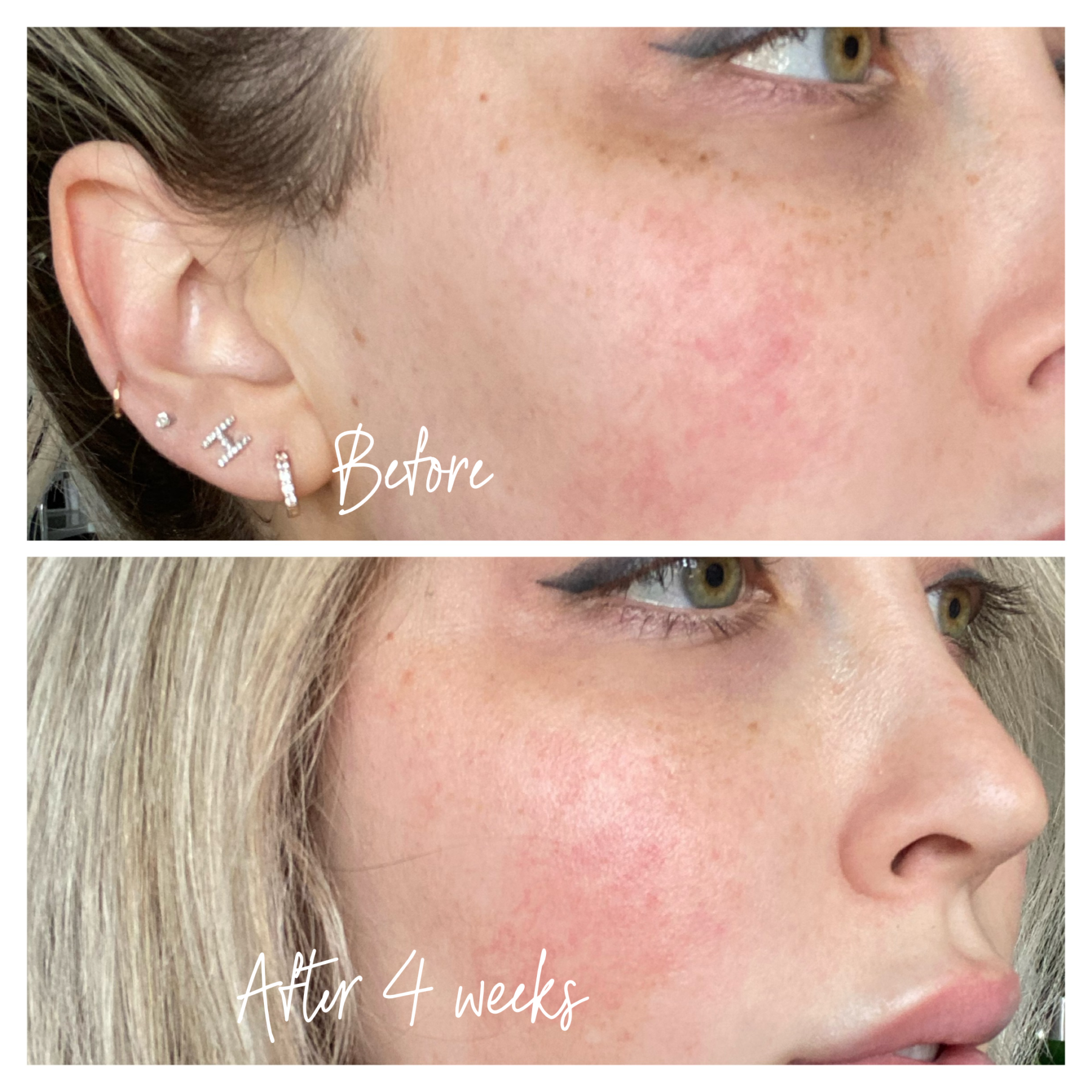 Musely Dark Spot Remover | Skincare | Sun Spots | Blondie in the City by Hayley Larue